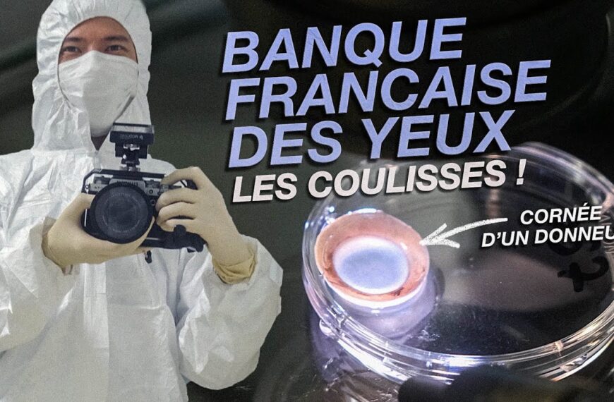 Les coulisses de la Banque Française des Yeux